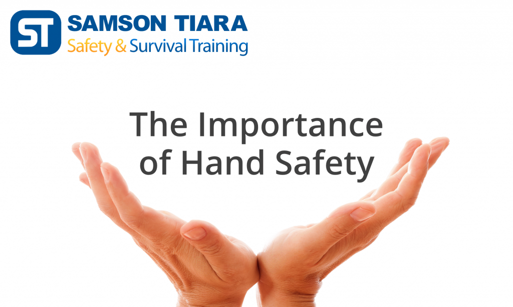 The Importance of Hand Safety Samson Tiara